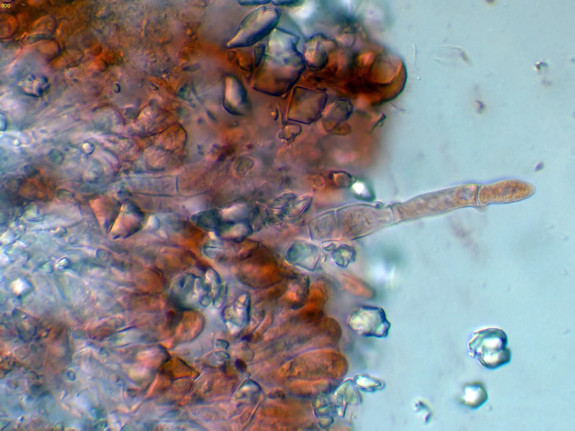 Microscopía de Peniophorella rude - 10 - Himenio-006